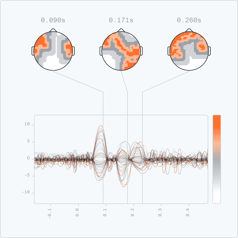 EEG signal